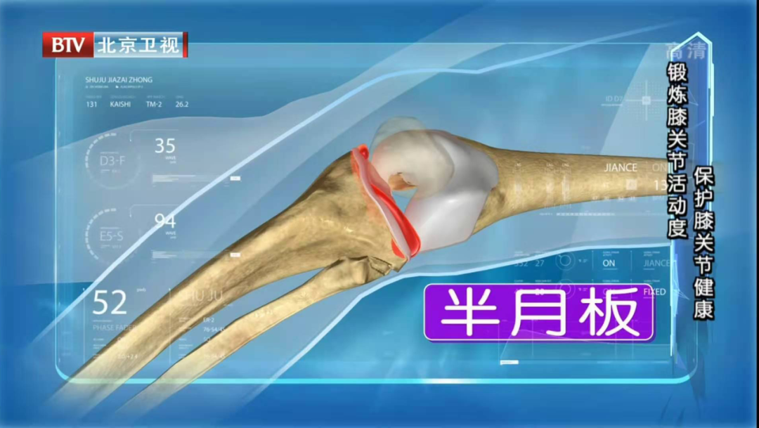 干細胞治療半月板損傷臨床試驗患者招募！