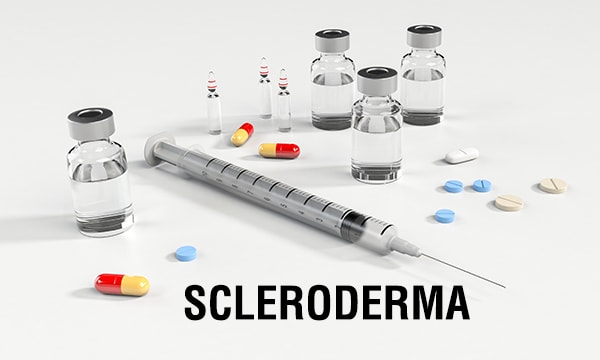 嚴重硬皮病的治療通常包括注射免疫抑制劑；通過(guò)這種方法10年生存率為55%
