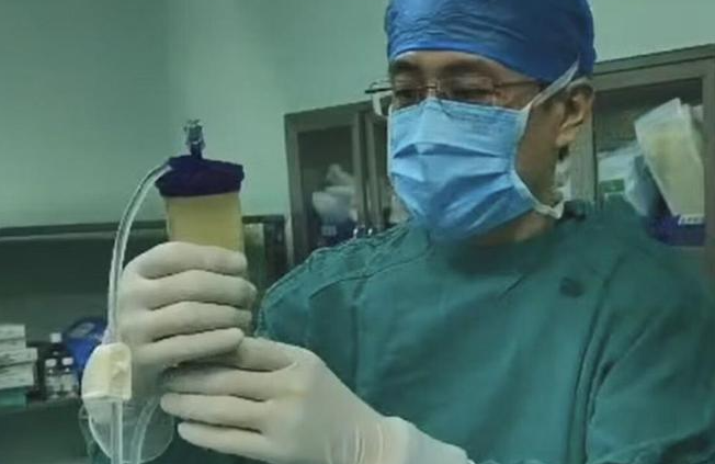 青島市中心醫院：創(chuàng  )新脂肪干細胞療法，為60歲患者解除十年關(guān)節炎困擾