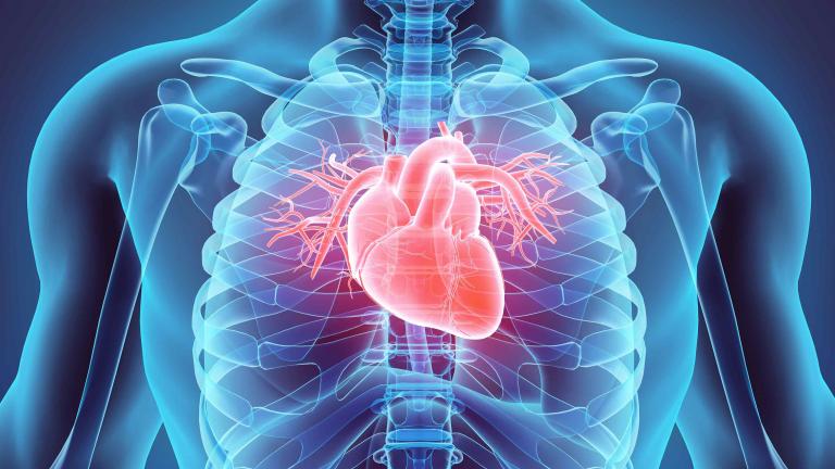 心血管疾病(Cardiovascular disease)