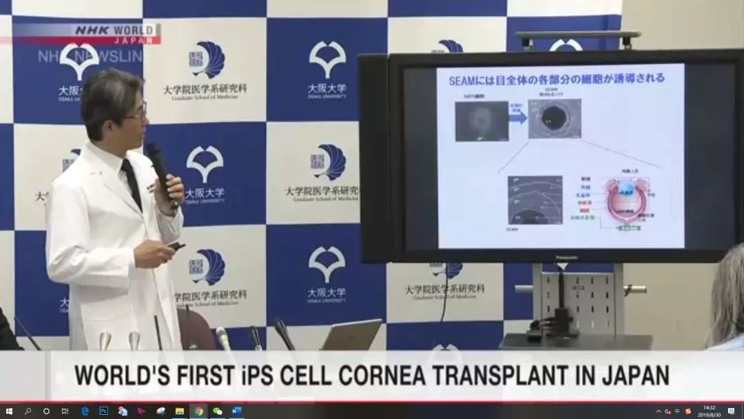 干細胞治療角膜疾病臨床案例