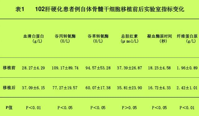 自體骨髓干細胞移植治療肝硬化102例報告。