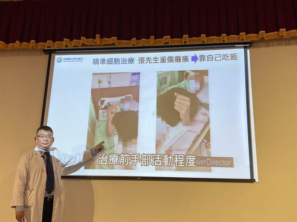 干細胞治療前